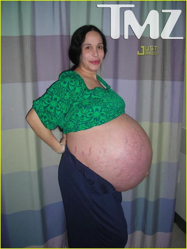 Nadya Suleman is better known as Octomom.  She was born Natalie Denise Suleman on July 11, 1975.  After 14 children she is stripping and making porn...  She is obviously very pregnant in this TMZ picture (with 8 kids).

Wow talk about stretch marks