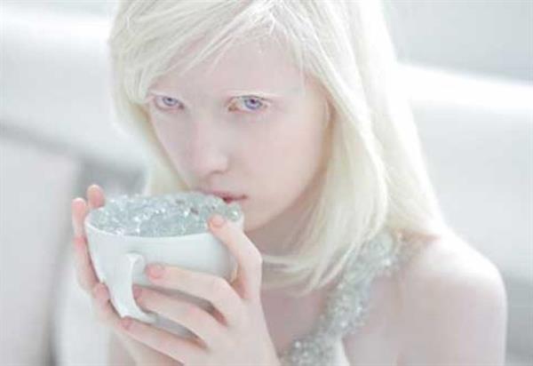 Beautiful albinos model