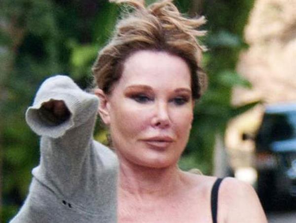 Jocelyn Wildenstein