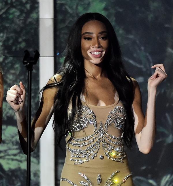 Winnie Harlow