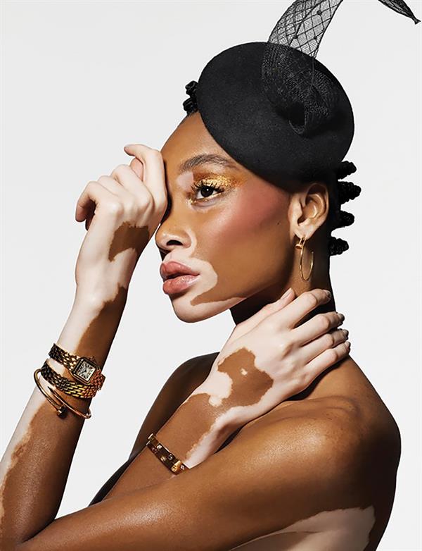 Winnie Harlow