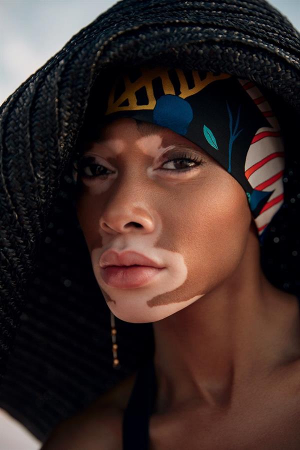 Winnie Harlow