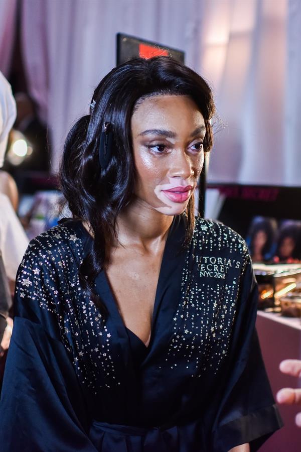 Winnie Harlow